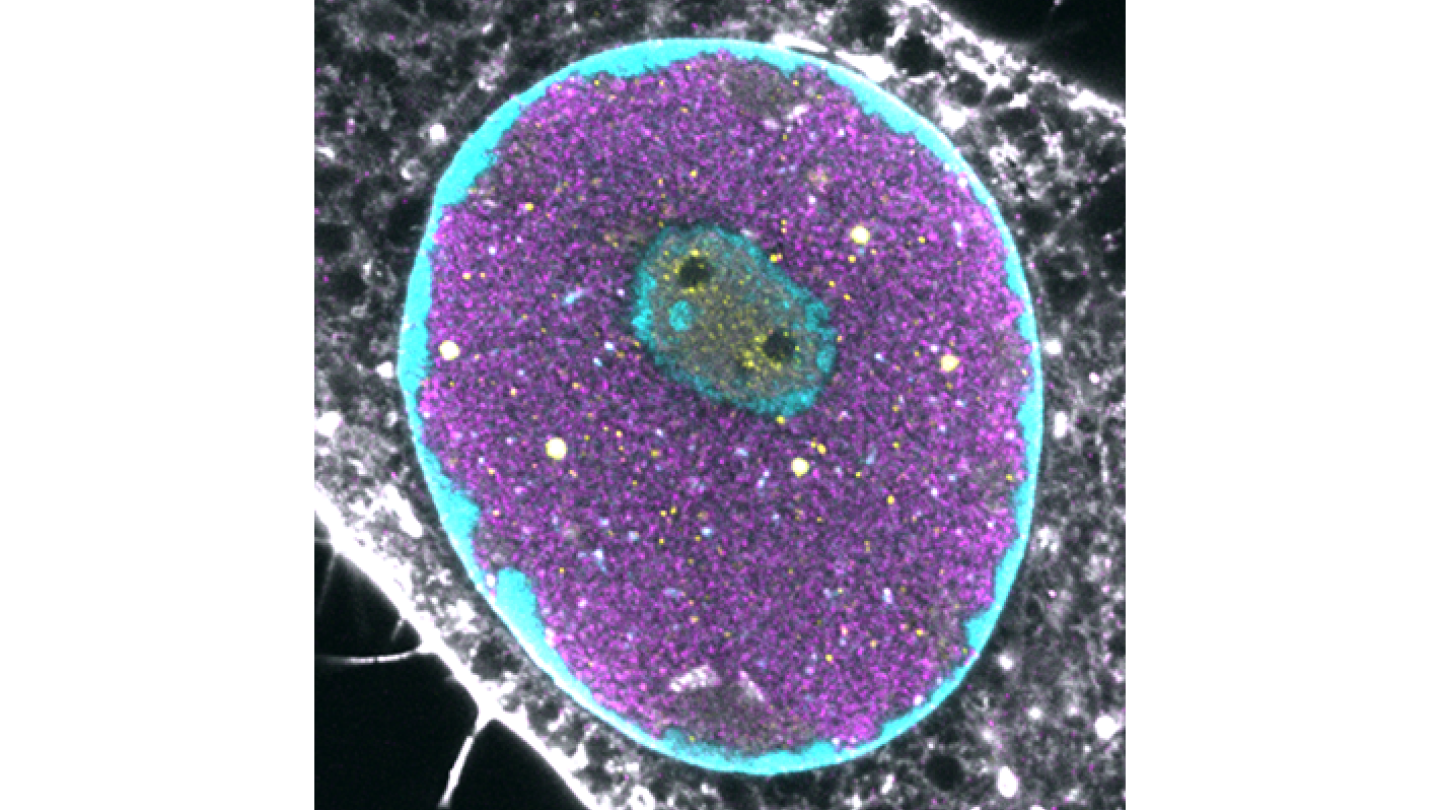 Tumajyväsen rakenne parvovirusinfektiossa