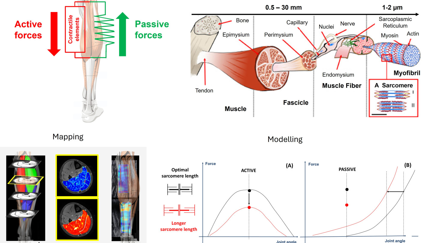 Overview of the project, starting from the clinical problem and progressing through multiscale analyses to the mapping and modeling of muscle properties
