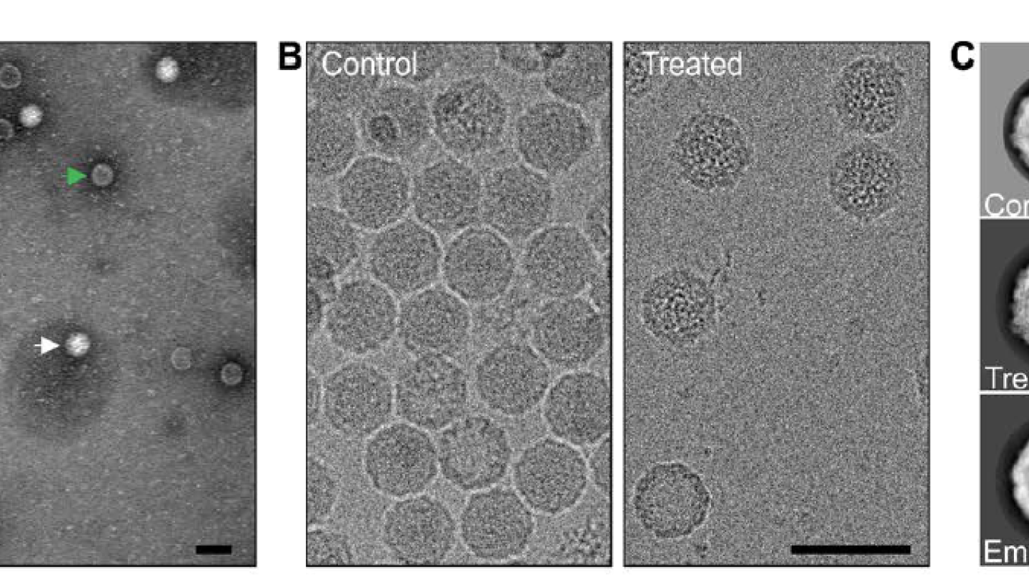 Enteroviruses in  electron microscope. Credit: University of Helsinki and University of Jyväskyla/Visa Ruokolainen and Ausra Domaska