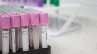 Laboratorion näyteputkia rivissä telineessä pöydällä