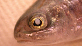 Parasiteinduced cataracts