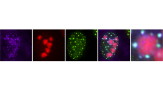 Viruksen lähetti RNA:n kerääntyminen tumatäpliin