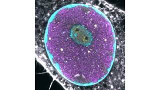 Tumajyväsen rakenne parvovirusinfektiossa
