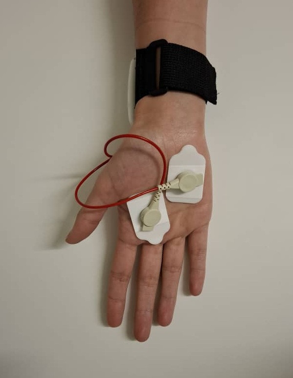 EDAMove electrodes on the palm