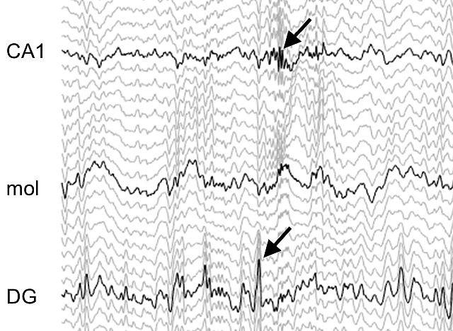 Localfield potentials from the rat hippocampus.