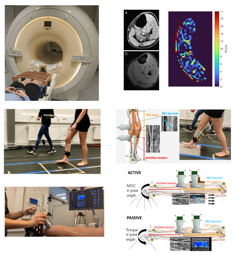 Some of the activities of the research group include MRI, ultrasound muscle–tendon imaging during walking, and ultrasound combined with torque assessments